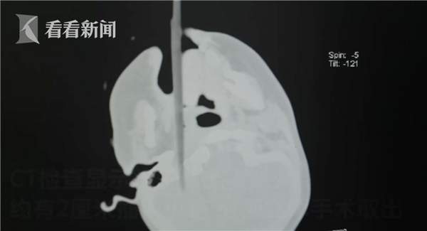 第2张图片