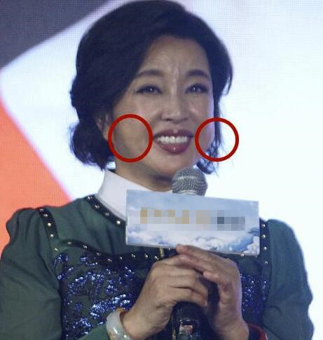 第6张图片