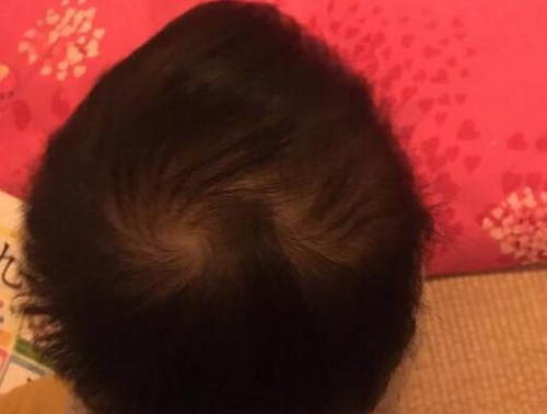 第3张图片